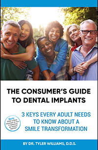 The Consumer's Guide to Dental Implants